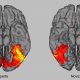 Gehirnaktivitäten | Foto: The Neuroscience of Expertise (Cambridge University Press)