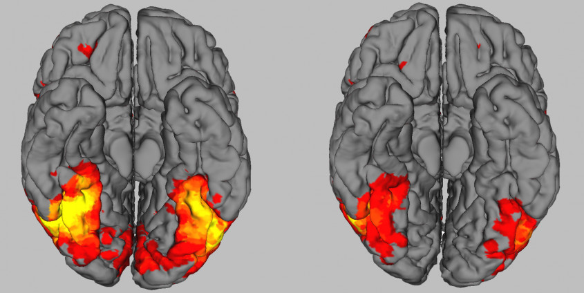 Gehirnaktivitäten | Foto: The Neuroscience of Expertise (Cambridge University Press)